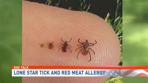 LONE STAR TICK BITE COULD CAUSE LIFETIME ALLERGY TO RED MEAT